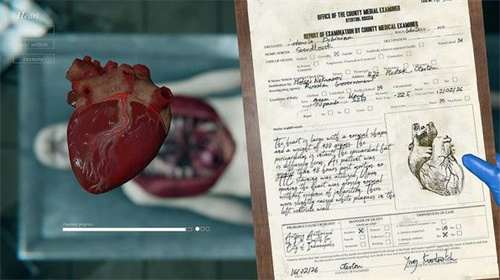 尸检模拟器汉化版(4)